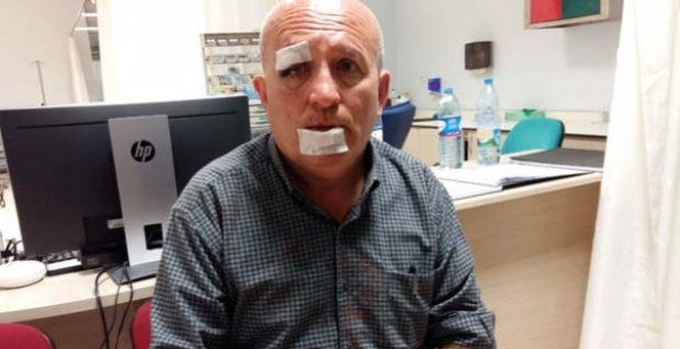 Otobüs kazasında yaralananların isimleri belli oldu